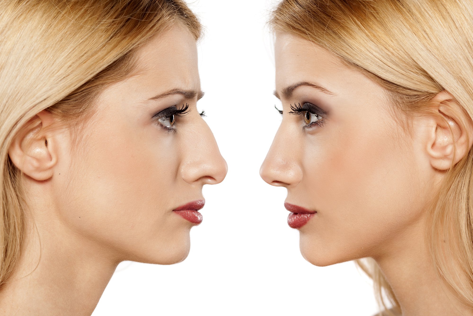 Afdeling Forkert Vil ikke 13 Tips to Speed Up Your Rhinoplasty Recovery Time - Dr. Farrior